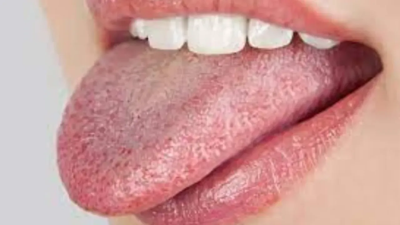 Tongue Tips: నాలుక మంటను వెంటనే తగ్గించే చిట్కాలు