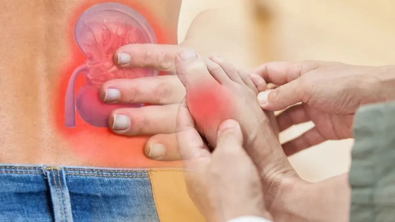 Uric Acid: యూరిక్ యాసిడ్ ఎవరికి ఎక్కువ ప్రమాదాన్ని తెస్తుంది  