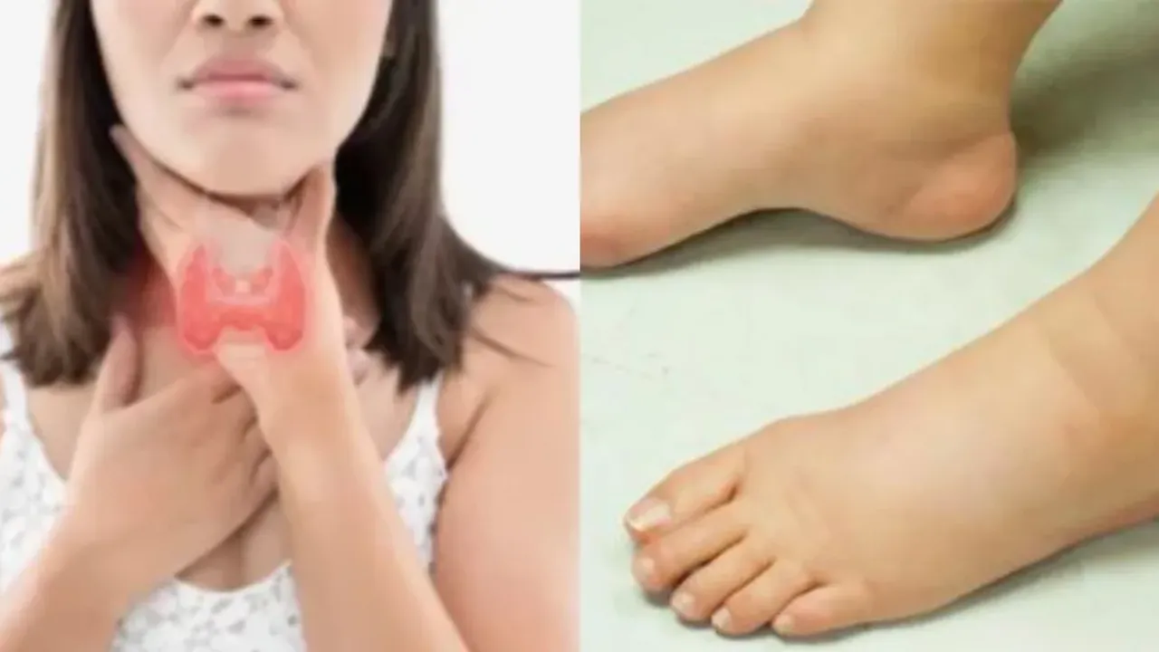 Feet Swelling: పాదాల్లో వాపు ఎందుకు వస్తుంది..సకాలంలో గుర్తించకపోతే అంతేనా?
