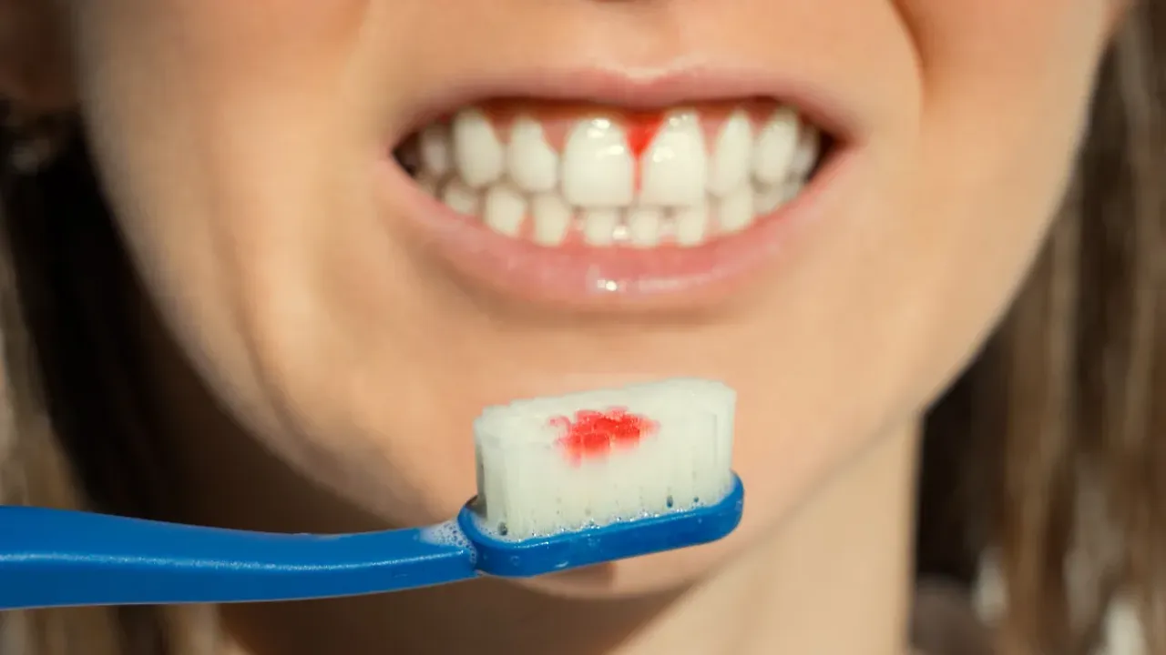 Teeth Tips : దంతాల్లో రక్తం వస్తే అది దేనికి సంకేతం.. ప్రమాదకరం అవుతుందా..?