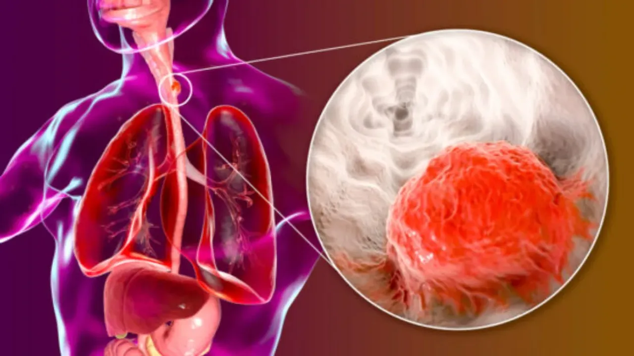 Health Tips: క్యాన్సర్ కణాలకు ఈ కూరగాయలతో చెక్.. సరిగ్గా తింటే క్యాన్సర్ రమ్మన్నా రాదు!