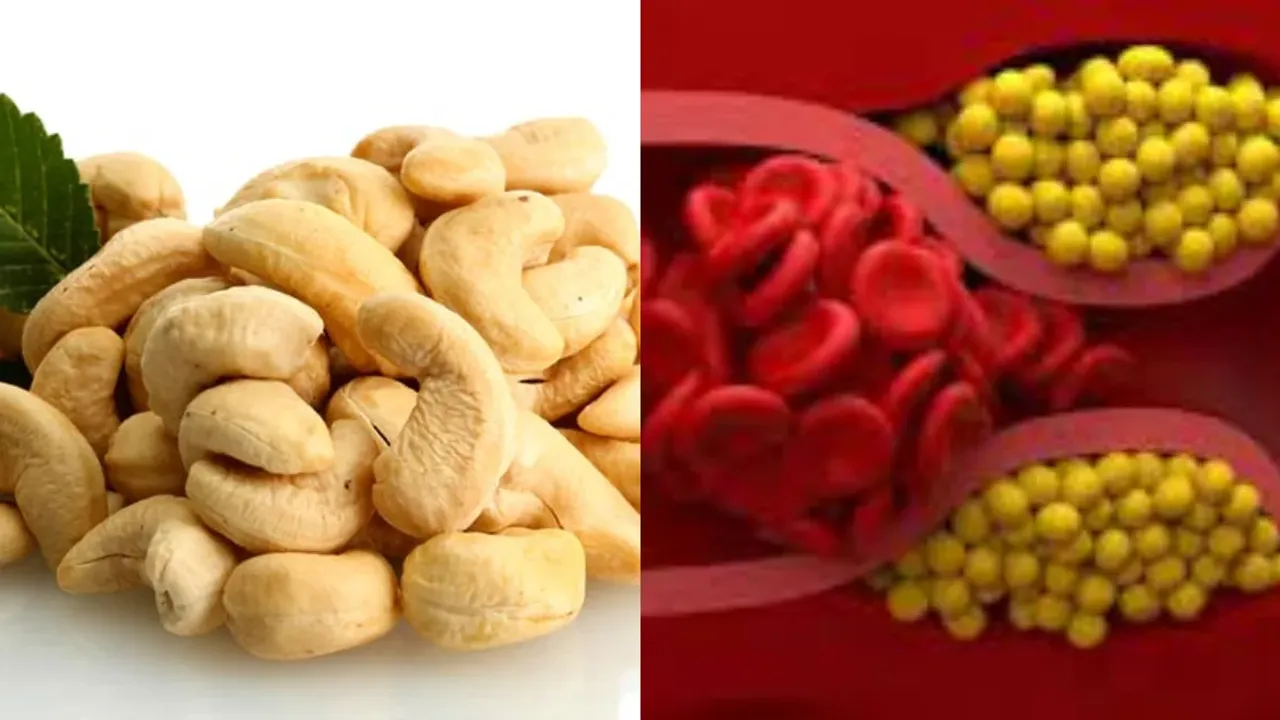 Cholesterol: కొలెస్ట్రాల్‌ మాయం చేసే జీడిపప్పు.. రోజుకు ఎన్ని తినాలో తెలుసా?