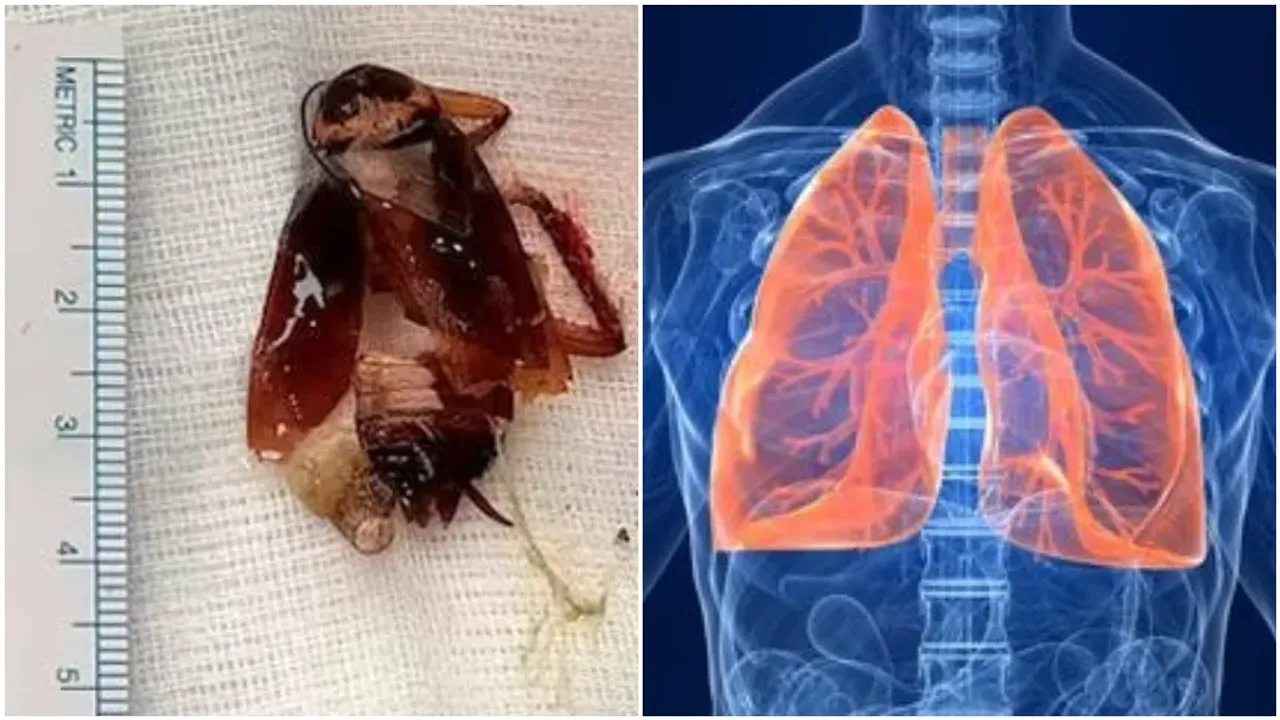 Cockroach: వృద్ధుడి ఊపిరితిత్తుల్లో బొద్దింక.. కంగుతిన్న డాక్టర్లు!