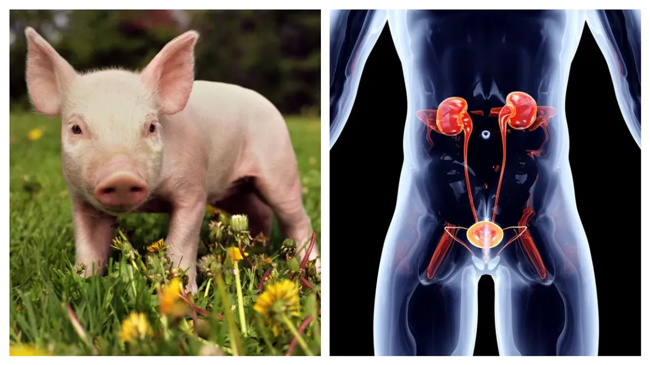 Kidney: పంది కిడ్నీనీ మనిషికి అమర్చిన అమెరికన్ వైద్యులు!