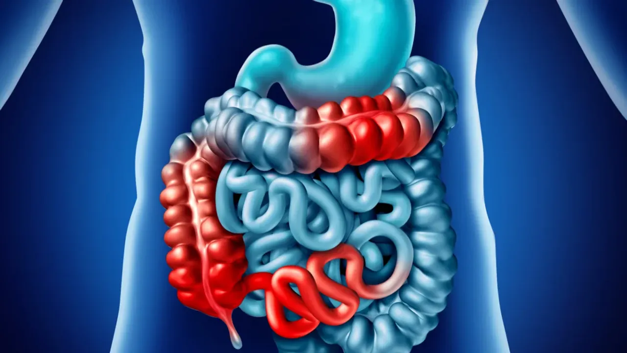 Health Tips: పేగువాపు లక్షణాలు ఎలా ఉంటాయి..? ఏయే ముందు జాగ్రత్తలు అవసరం..?