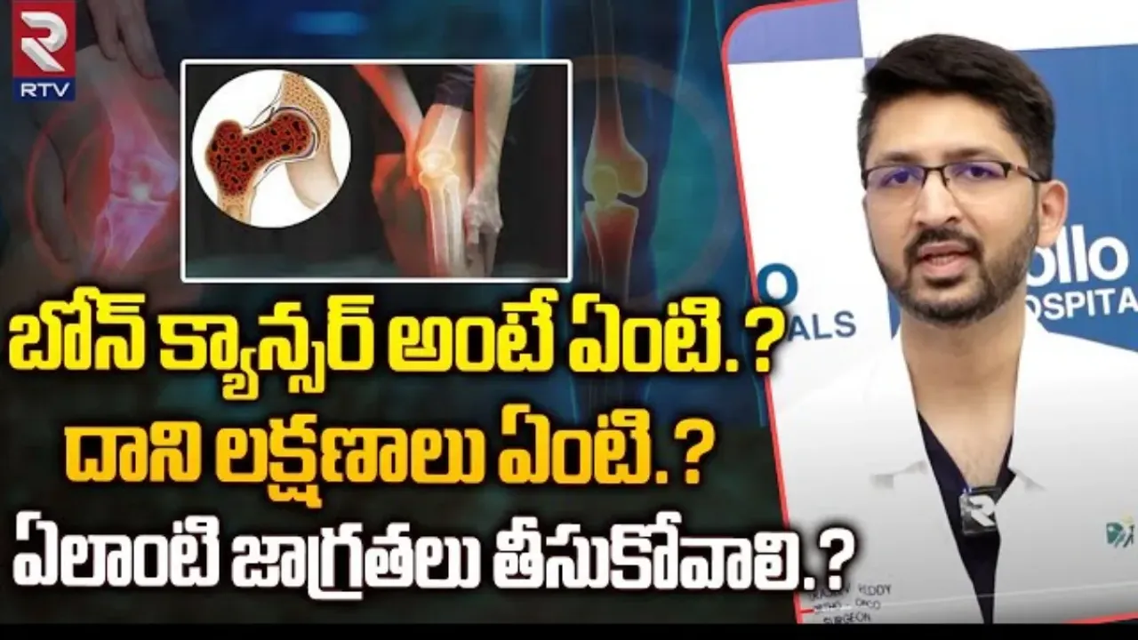 Bone Cancer: బోన్ క్యాన్సర్ అంటే ఏమిటి..? దాని లక్షణాలు ఏంటి..? ఎలాంటి జాగ్రత్తలు తీసుకోవాలి..?