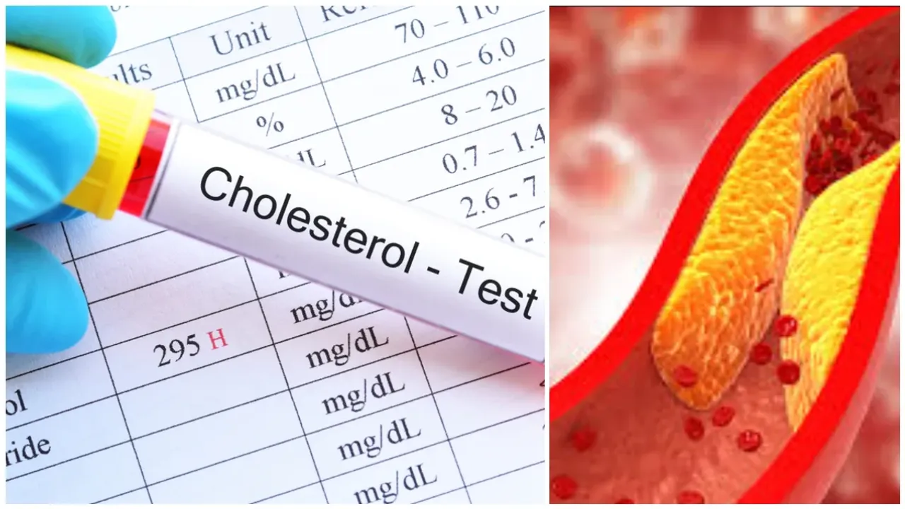 Cholesterol Test : కొలెస్ట్రాల్ టెస్ట్ కు వెళ్లేముందు ఈ పొరపాట్లు అస్సలు చేయకండి.. జాగ్రత్త..!
