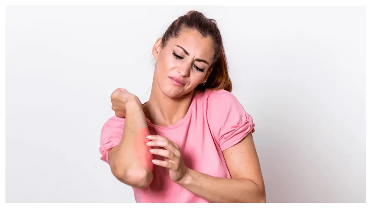 Home Remedies : తేనెని ఇలా రాస్తే కాలిన గాయాలు, మచ్చలు తగ్గిపోతాయట..