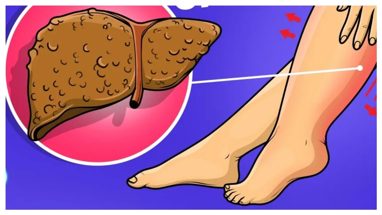 Liver Health : ఈ భాగాల్లో వాపు వస్తే లివర్ డ్యామేజ్ అయినట్లే!