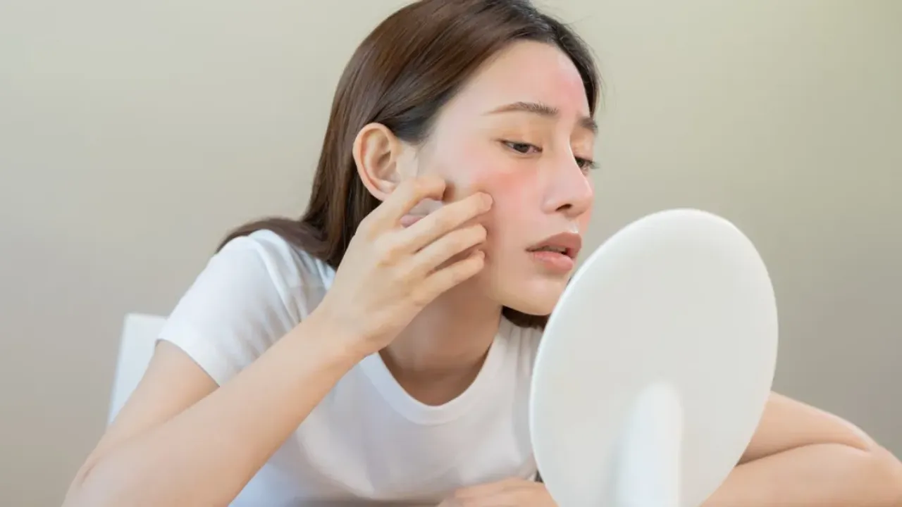 Skin Care : మొహానికి టూత్ పేస్ట్ అప్లై చేస్తున్నారా..? మీ అందం పాడైనట్లే..జాగ్రత్త..!