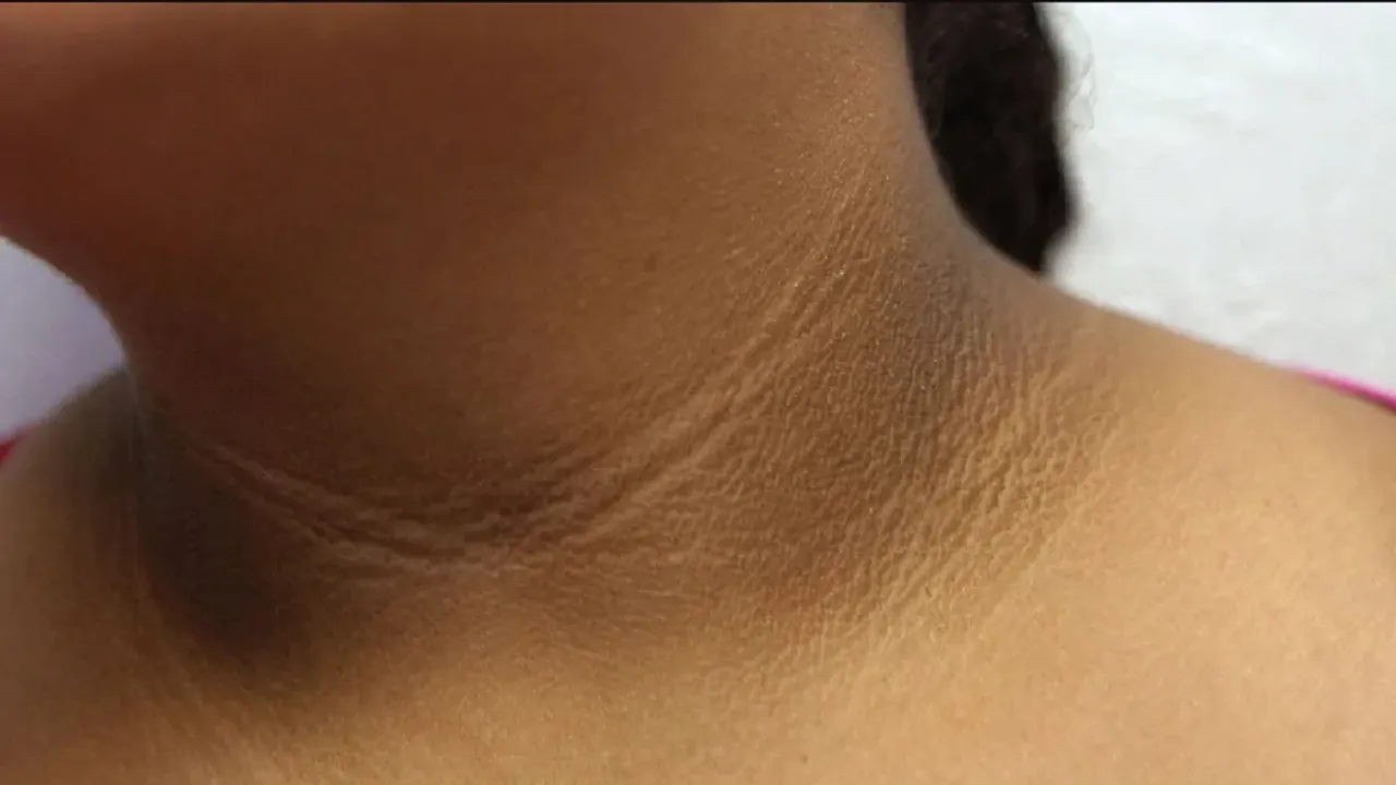 Beauty Tips : మెడ భాగంలో నల్లగా మారిందా..? ఇది అప్లై చేయండి దెబ్బకు మాయం..!