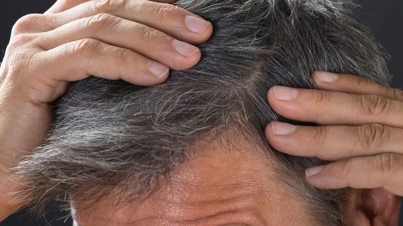 Health Tips: తెల్ల జుట్టు వల్ల ఆరోగ్యానికి ముప్పు