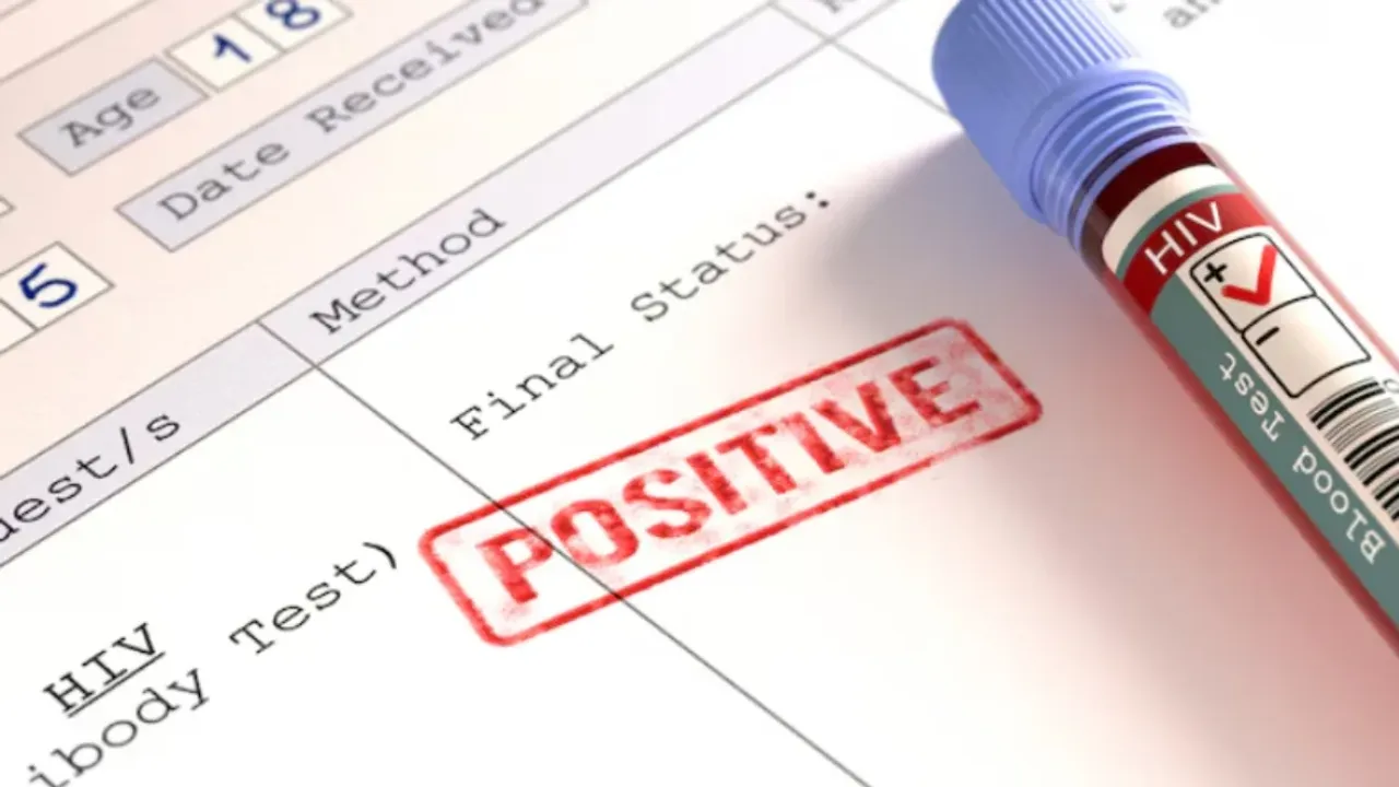 HIV: వాంపైర్‌ ఫేషియల్‌ చేయించుకున్న మహిళలకు హెచ్‌ఐవీ!