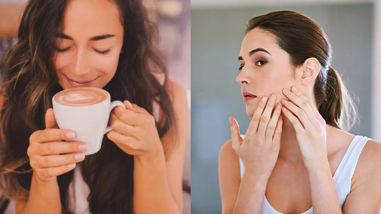 Coffee:  కాఫీ తాగితే ముఖంపై మొటిమలు వస్తాయా? ఇది నిజమేనా?