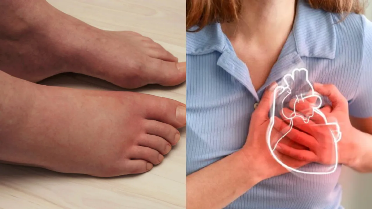 Swollen Feet: మీ పాదాలు ఉబ్బి ఉంటే ఇలా చేయండి... లేకపోతే ఆ వ్యాధుల ప్రమాదం తప్పదు!