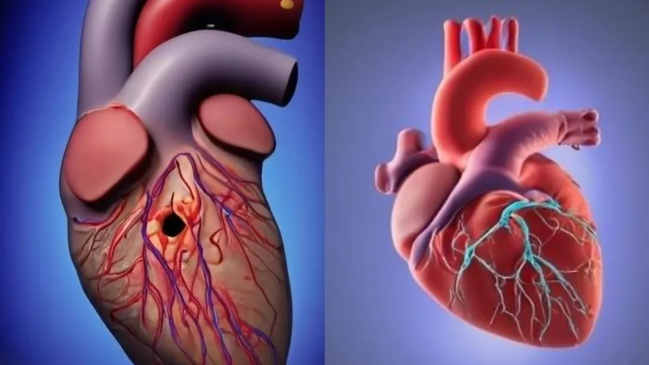 Heart Health: గుండెలో రంధ్రం అంటే ఏంటి? లక్షణాలు, చికిత్సను తెలుసుకోండి!