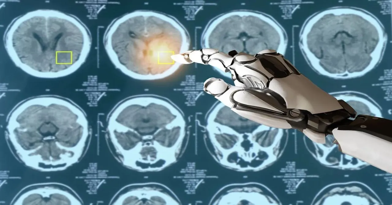 AI Cancer Treatment: ఇప్పుడు AI టెక్నాలజీ తో క్యాన్సర్ కు చికిత్స