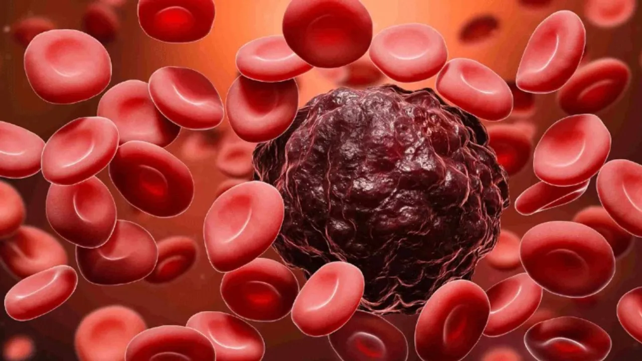 Blood Cancer: ఒక వ్యక్తికి బ్లడ్ క్యాన్సర్ ఉంటే.. శరీరంపై ఎలాంటి లక్షణాలు కనిపిస్తాయి?