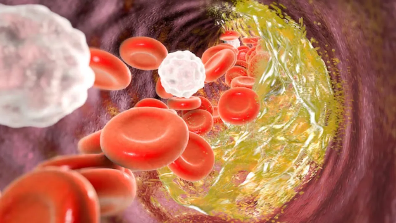 Cholesterol: ఈ లక్షణాలు కనిపిస్తే.. మీ శరీరంలో కొవ్వు పెరుగుతుందని అర్థం జాగ్రత్త..!