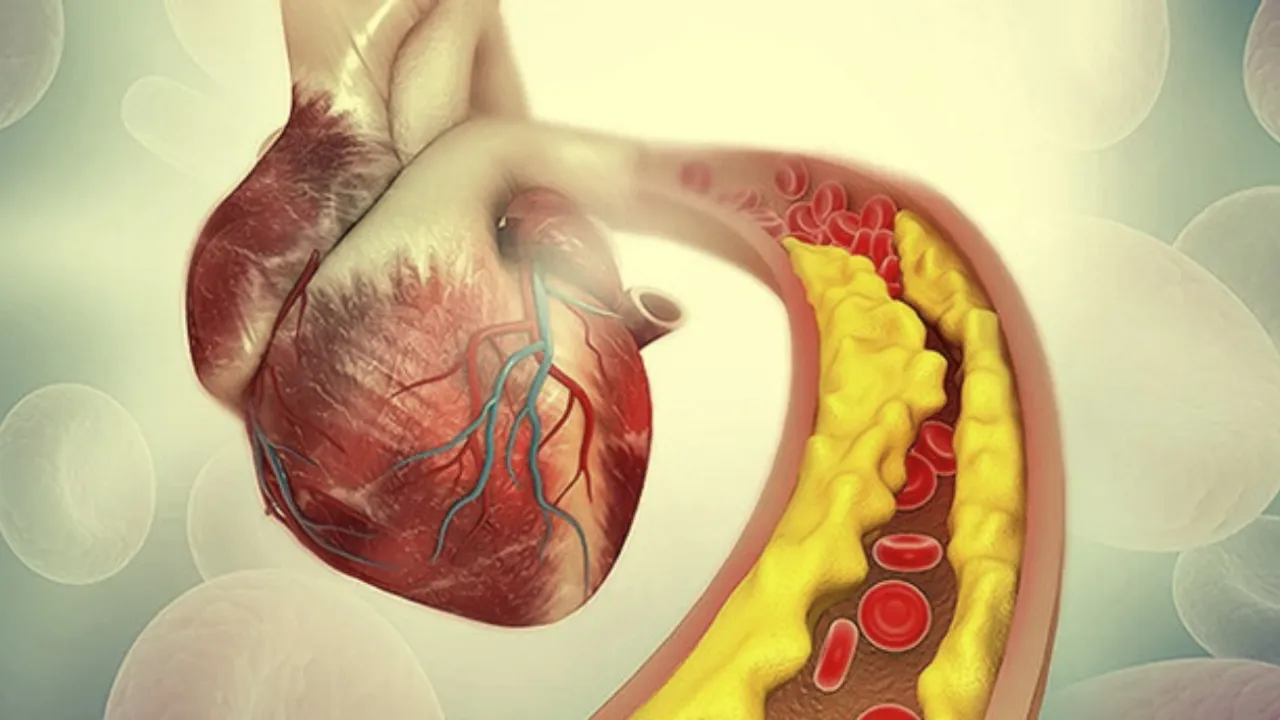 High Cholesterol: పెరిగిన కొలెస్ట్రాల్ నియంత్రణలోకి రావాలంటే? ఈ 5 పనులు చేయండి!