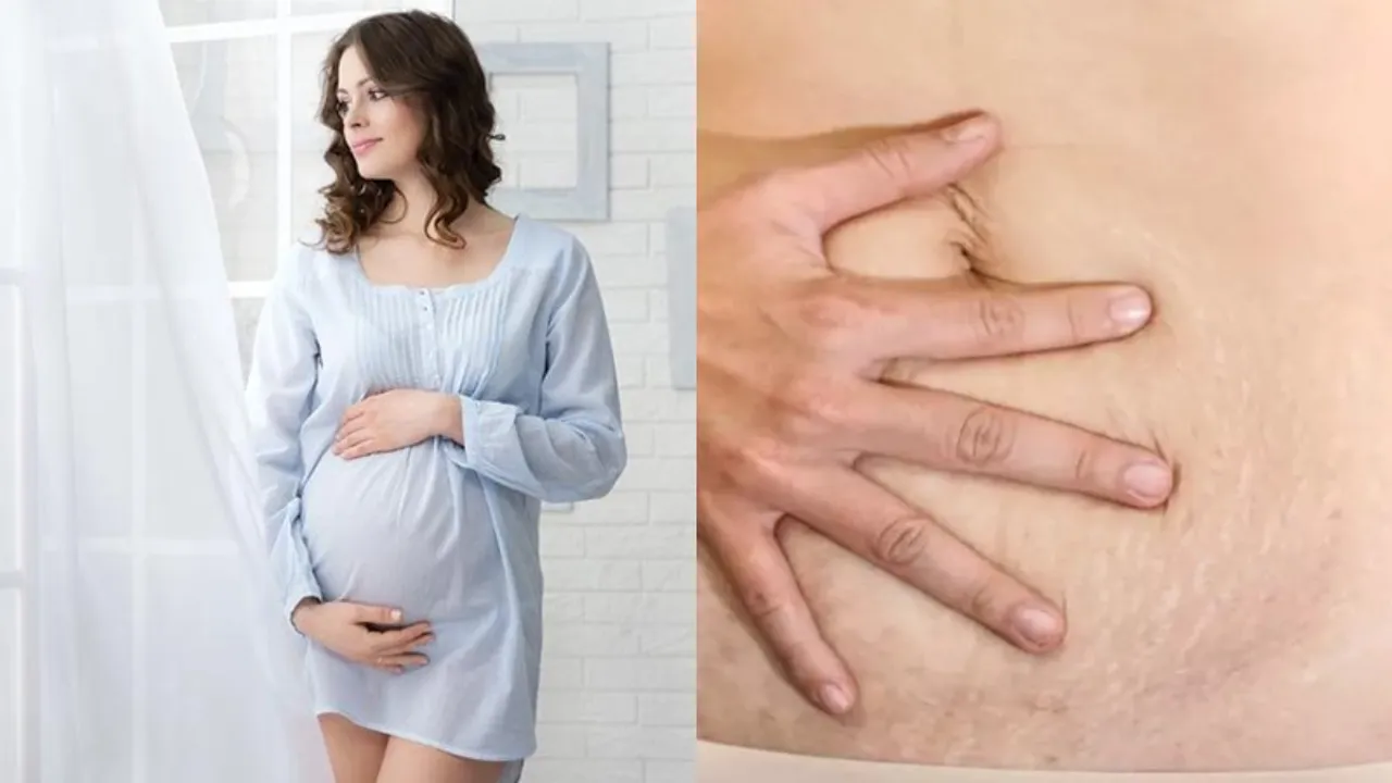 Postpartum Care: డెలివరీ తర్వాత చర్మం నిస్తేజంగా మారిందా? ఏం చేయాలో తెలుసుకోండి!