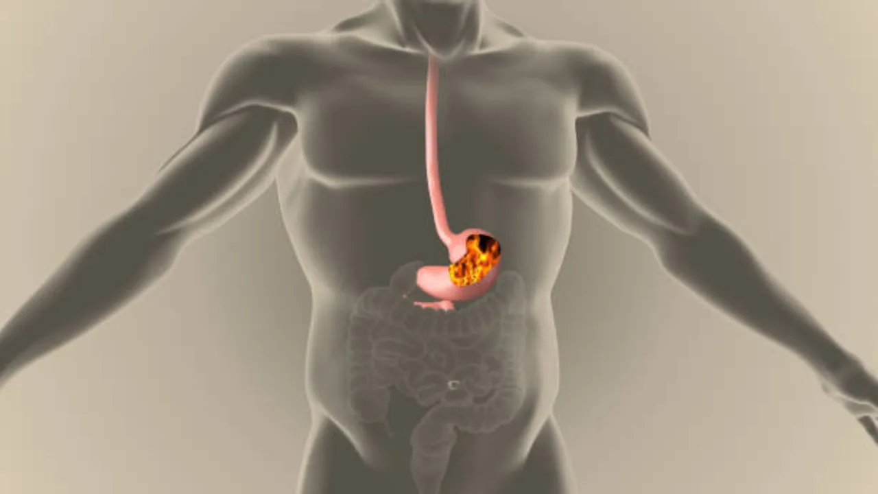 Acidity Reflux : మీరు అసిడిటీతో ఇబ్బంది పడుతుంటే ఇలా చేయండి.. వంటగదిలో ఈ వస్తువులను ఉంచండి!