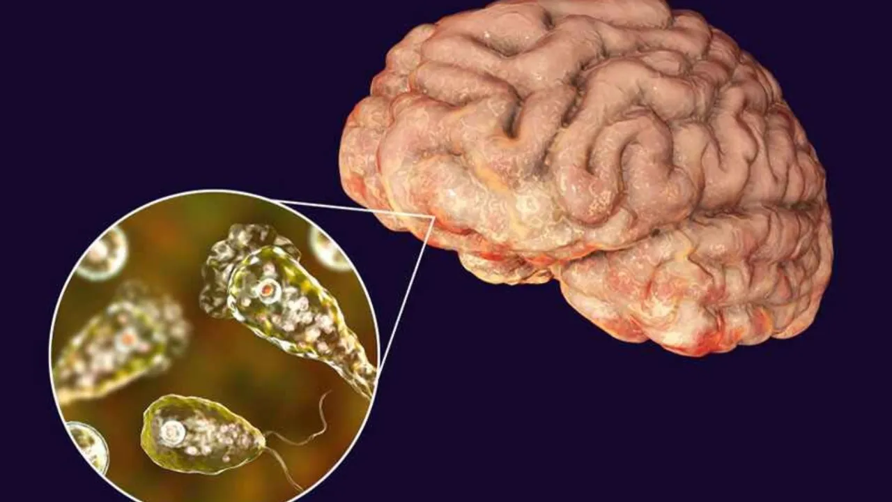 Brain-Eating Amoeba : కలవరపెడుతున్న మెదడు తినే అమిబా.. తాజాగా మరో కేసు