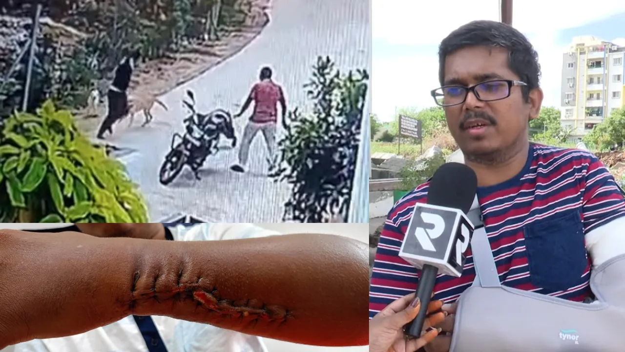 Hyderabad News: షాకింగ్ ఘటన.. రోడ్డుపైకి వచ్చిన పెంపుడు కుక్కలు ఎంత పని చేశాయంటే?