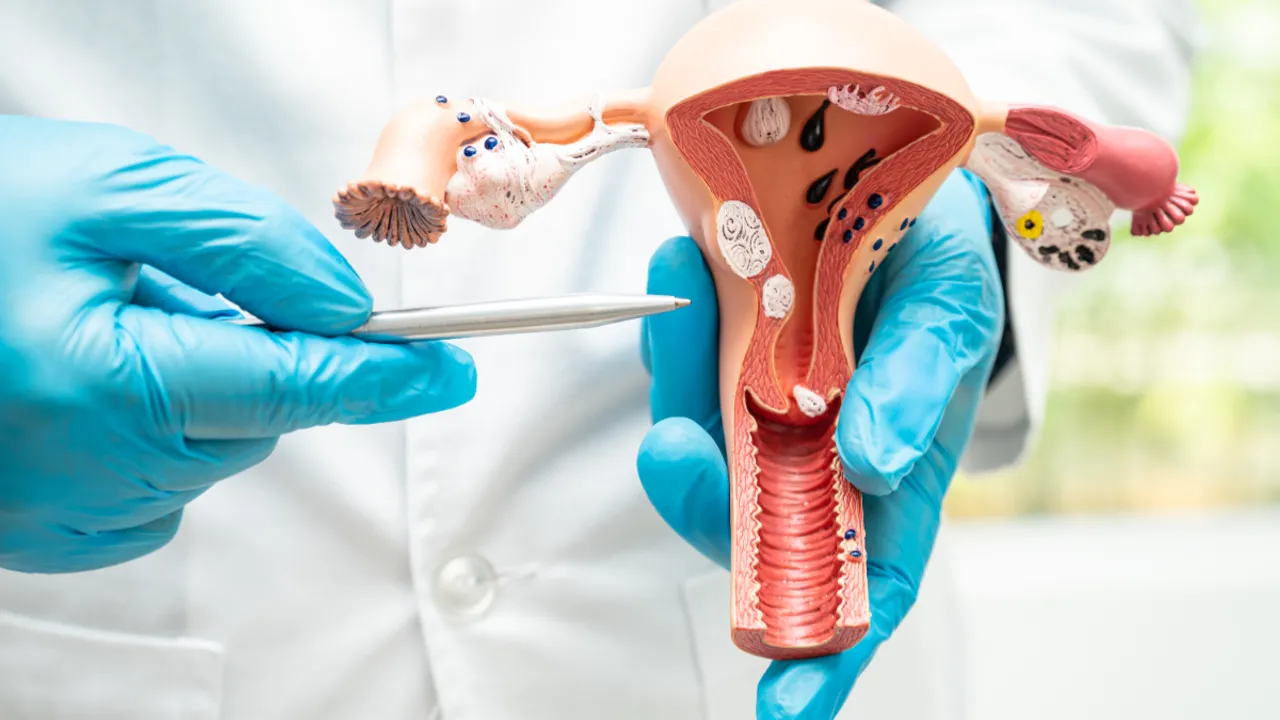 Ovarian Cancer: అండాశయ క్యాన్సర్‌ గురించి అసలు నిజం తెలుసుకోండి!