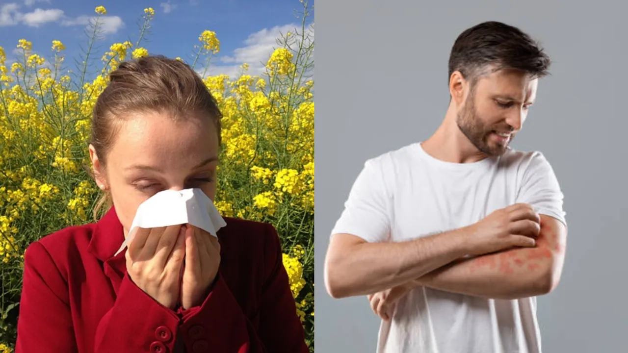 Seasonal Allergies: వర్షాకాలంలో అలర్జీలు రాకుండా ఈ జాగ్రత్తలు తీసుకోండి!