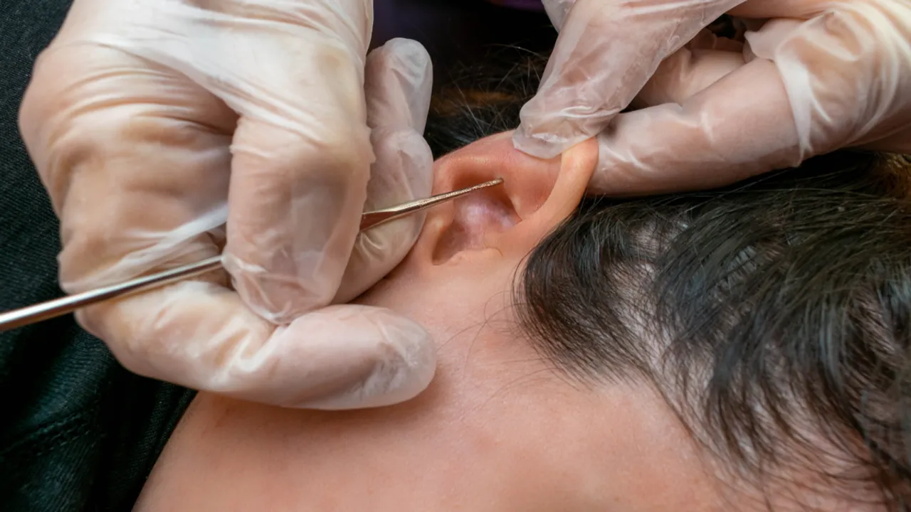 Ear Infection: వర్షం వల్ల వచ్చే చెవి ఇన్ఫెక్షన్‌ను ఇలా వదిలించుకోండి!