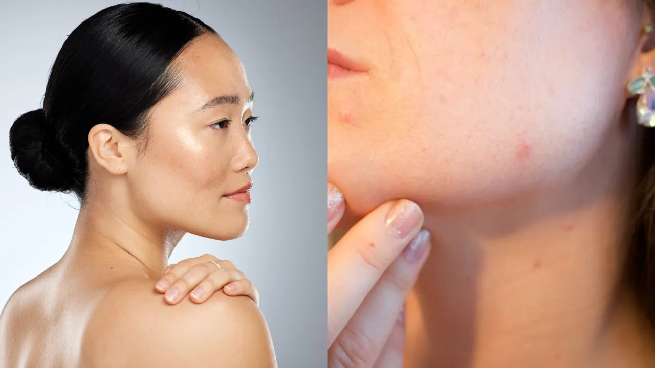 Skin Care