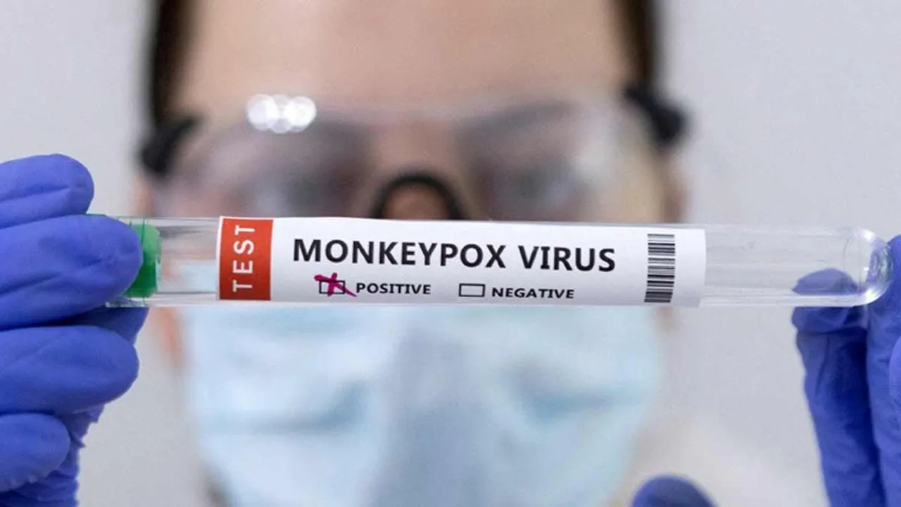 Monkeypox: ఇండియాలో మంకీపాక్స్ కలకలం.. ఆస్పత్రిలో అనుమానితుడు