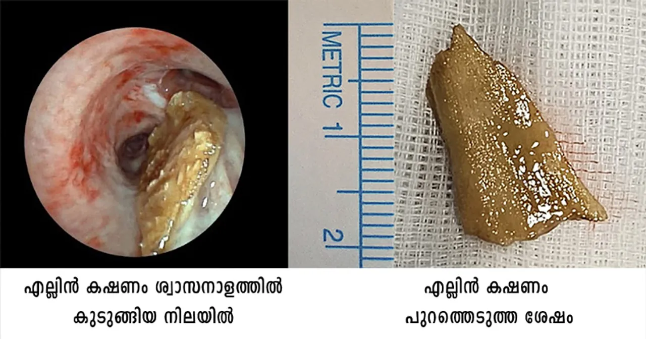 swasakosham12