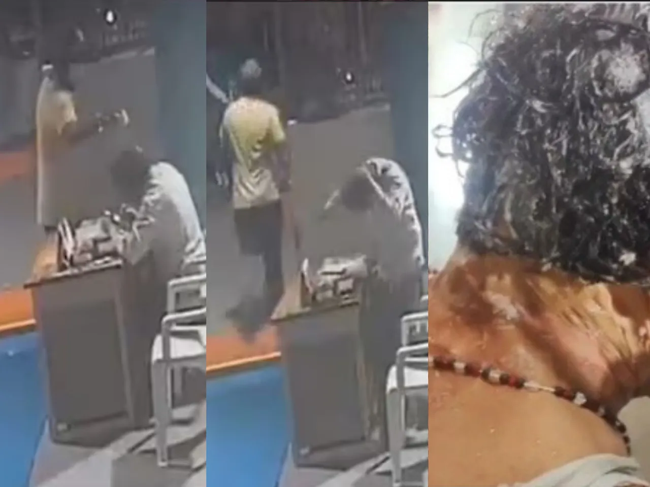 hyderabad temple acid attack