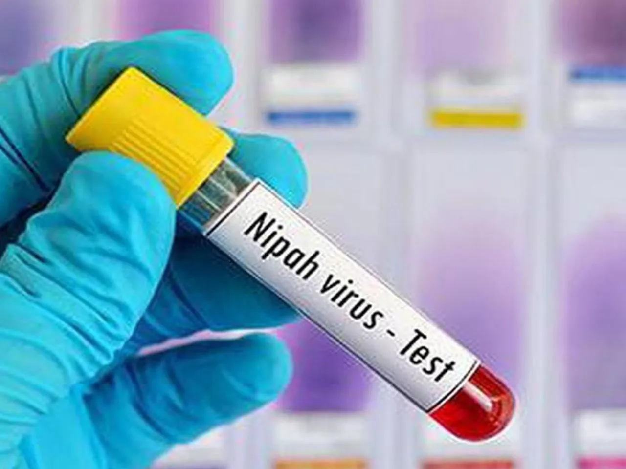 nipah virus test