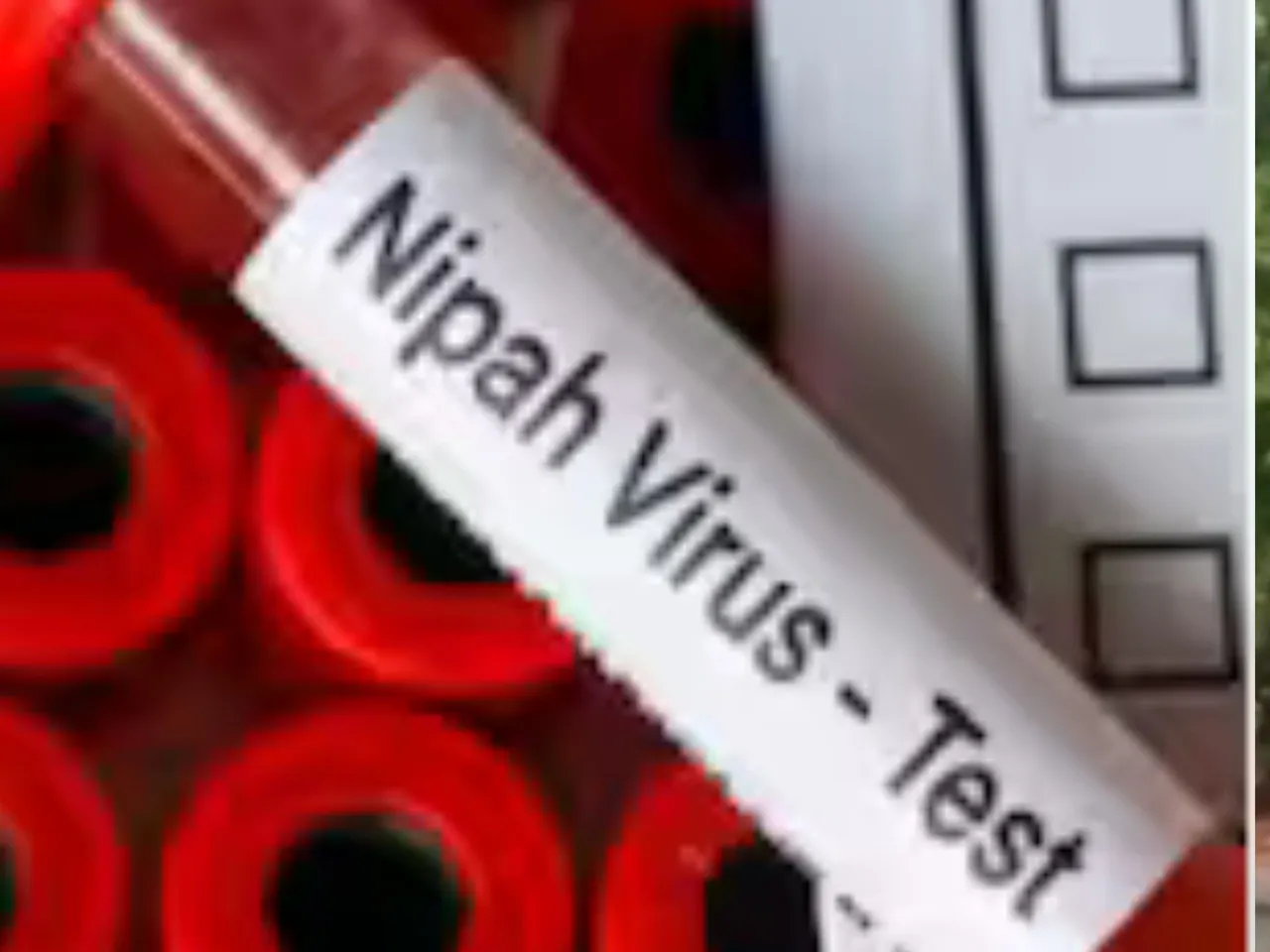 nipah negative virus