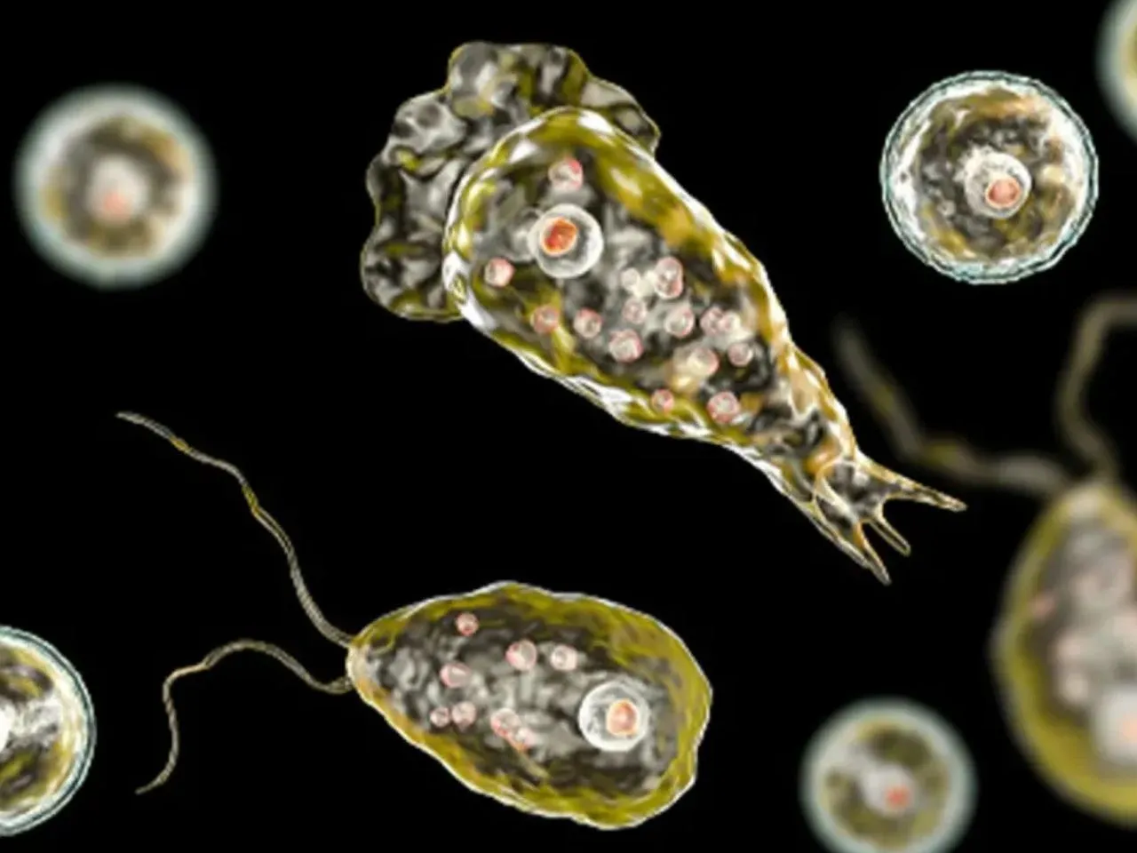 amebic brain fever