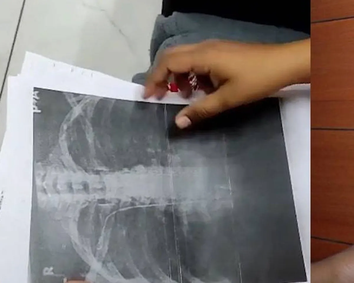 xray