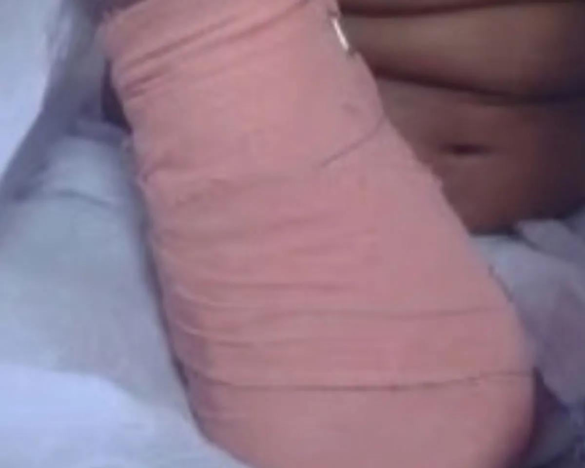 HAND