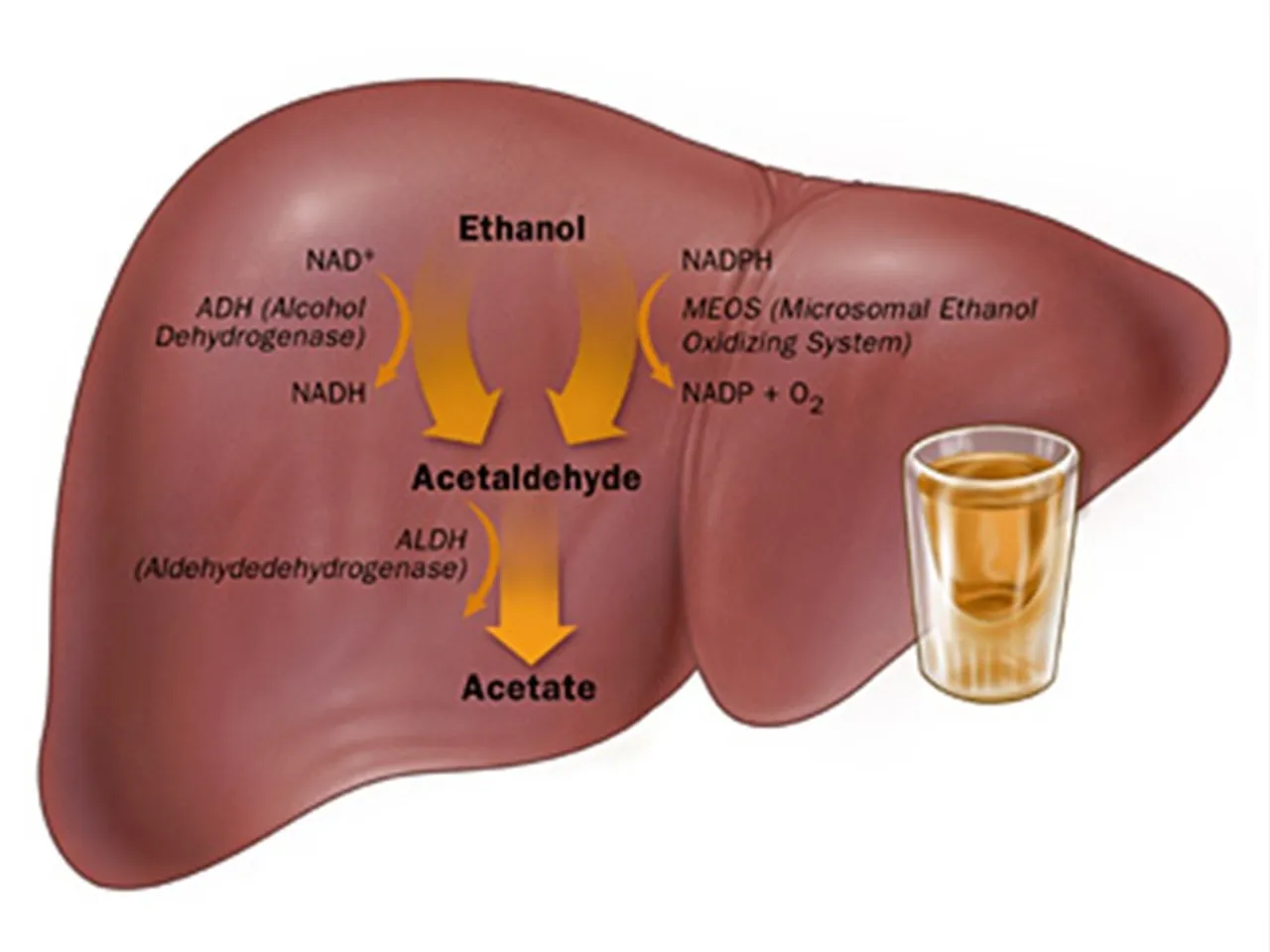 Alcoholic-liver-disease