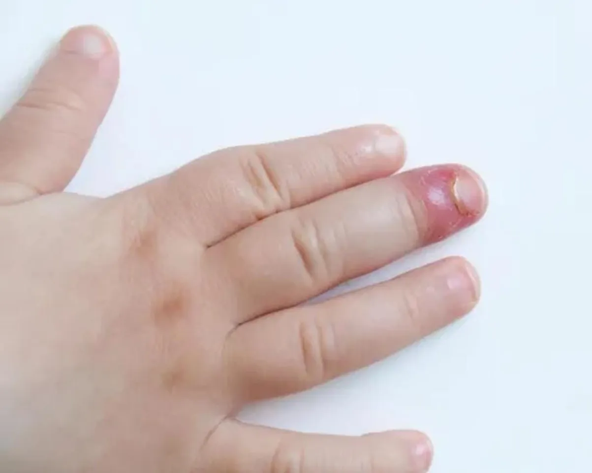 49f2a451-53fe-4ac4-8591-d9969e79a459