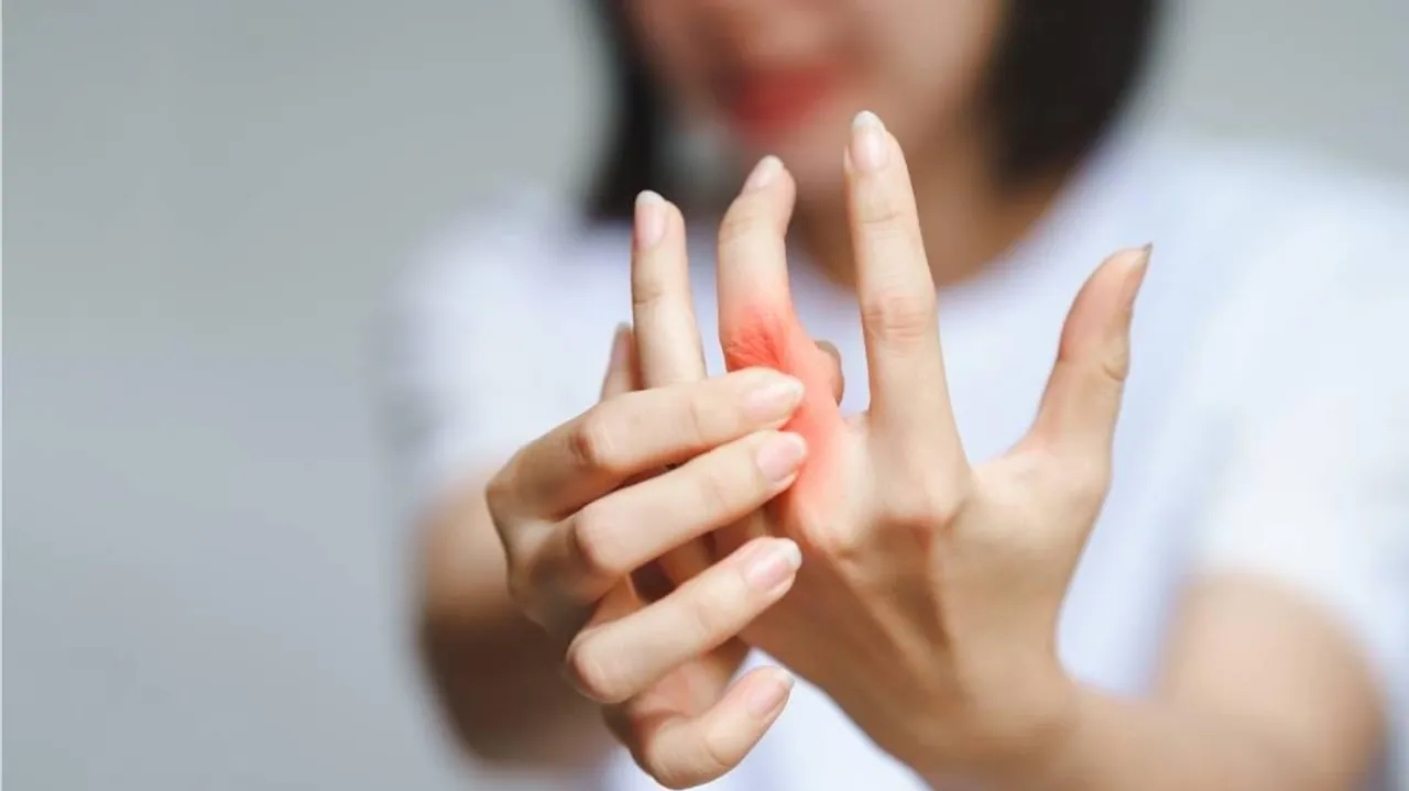 representative-image