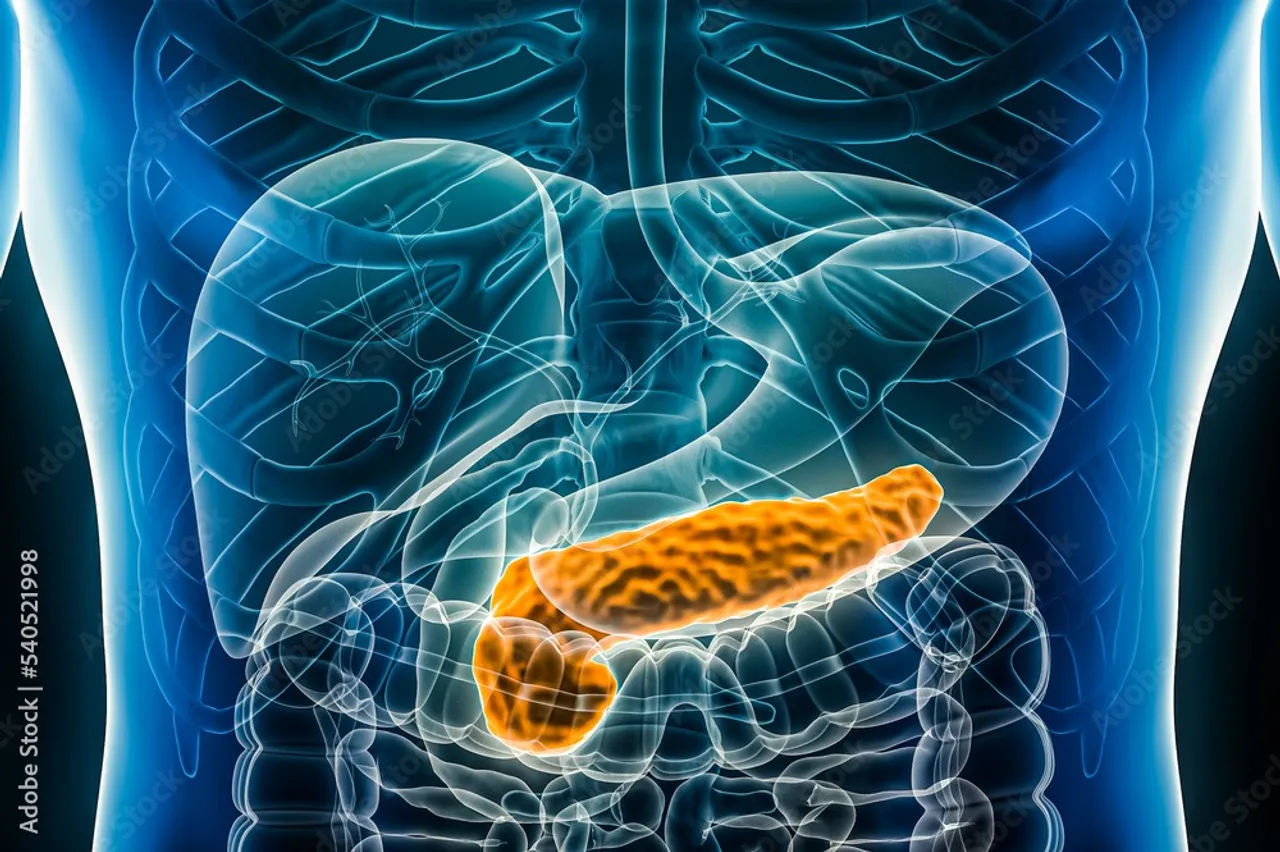 1000_F_540521998_7lZNDrv70aBj6CxYmY2kTFszM4d91xaJ