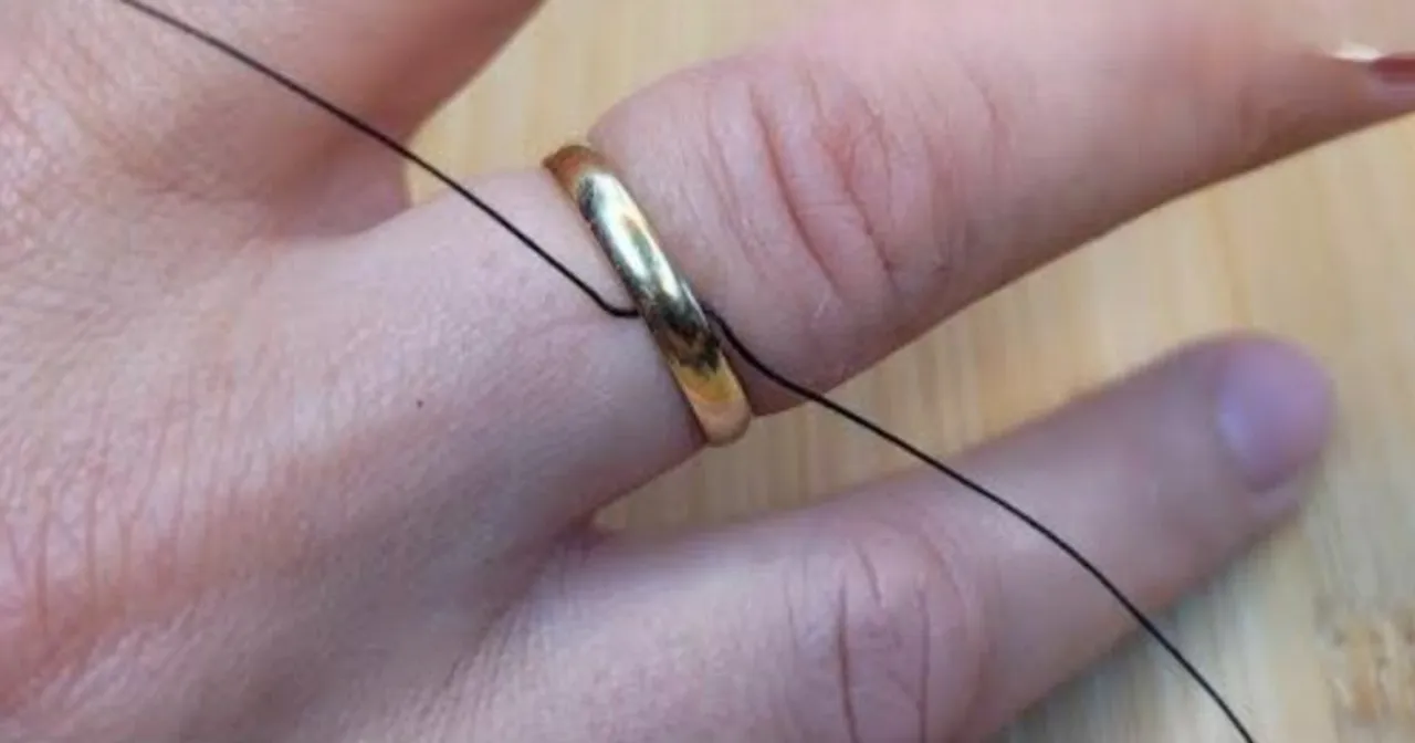 how-to-remove-the-ring-that-was-stuck-on-finger