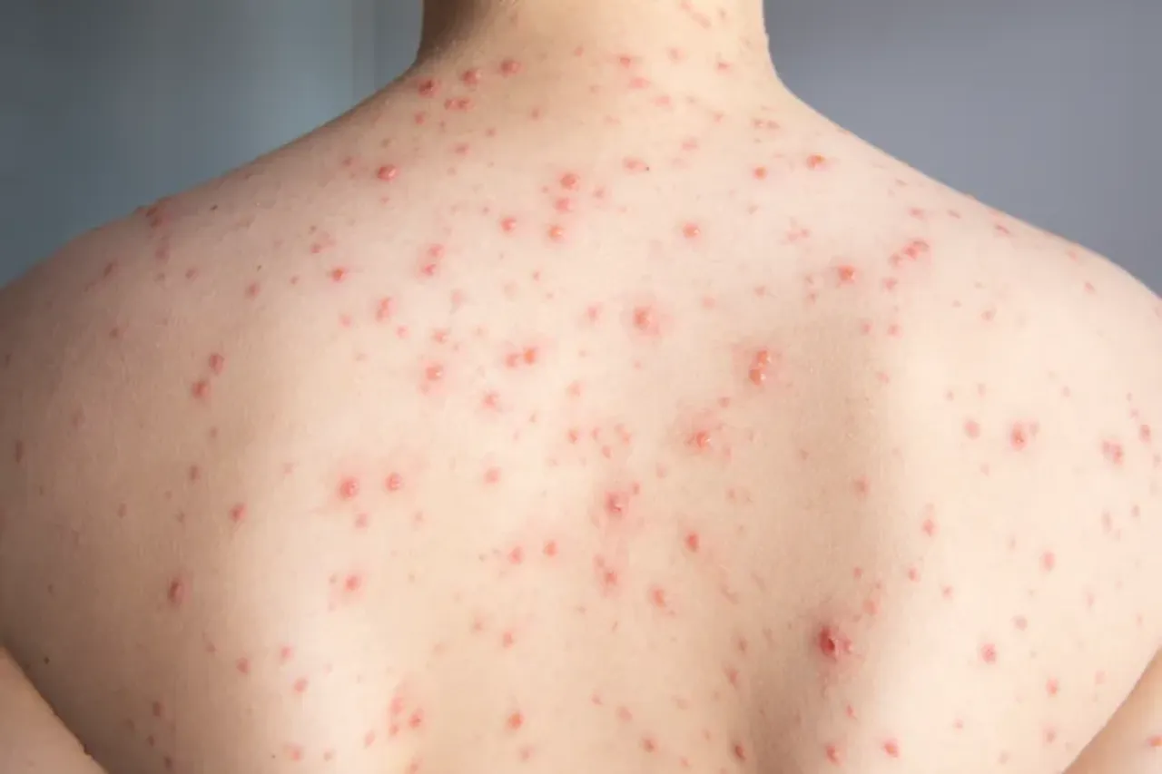 15420a50-6ede-11f0-affb-269d14098604