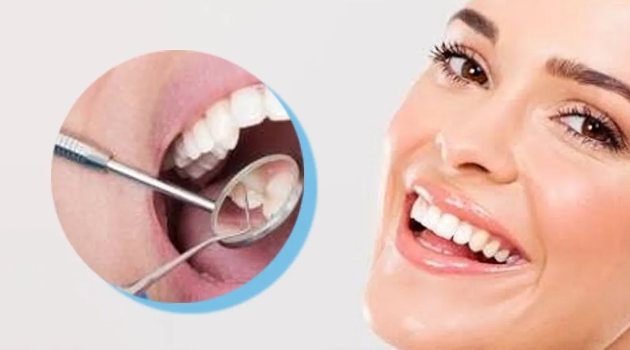 Root-canal-treatment