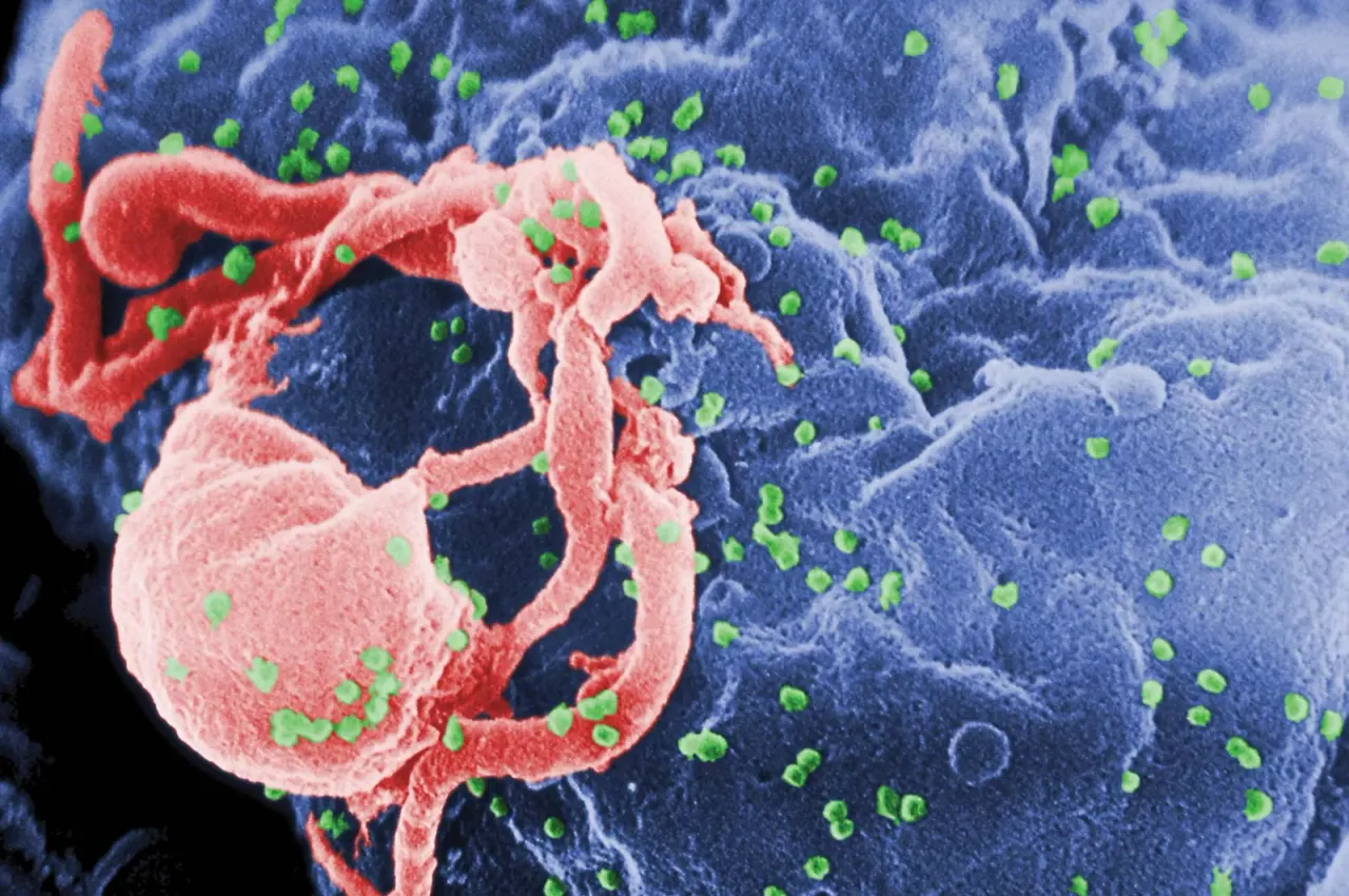 Scanning-electron-micrograph-virions-HIV-lymphocyte-bumps