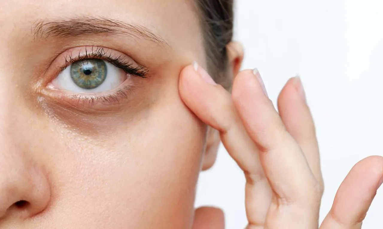 1420882-under-eye.jpg