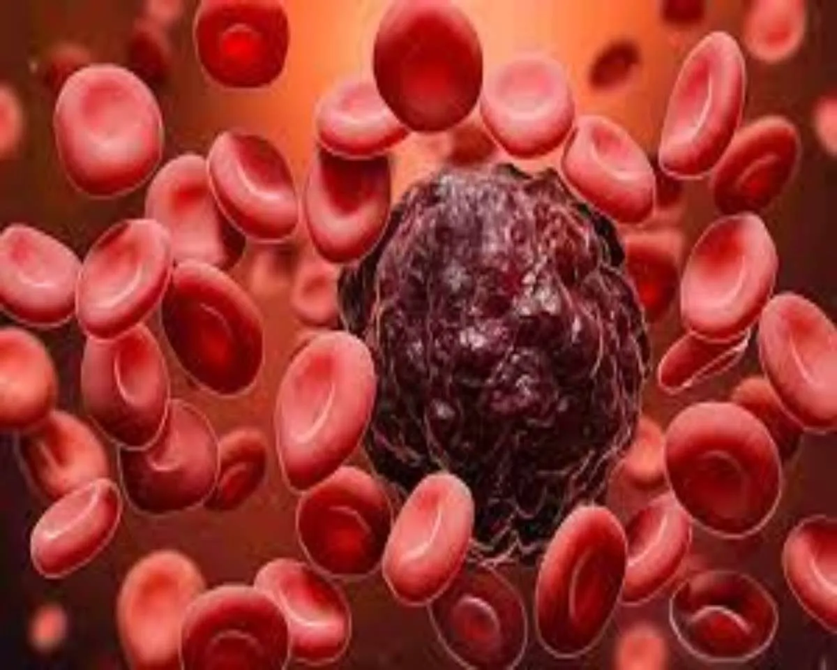 blood cancer.jpg